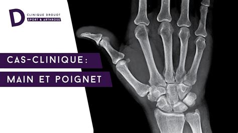 Thomsen Laurent Chirurgie orthopédique