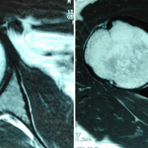 Zaraa Mourad Chirurgie orthopédique