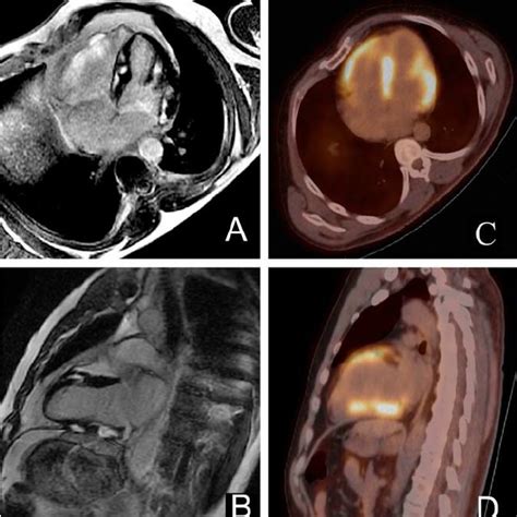 Barbou Franck Cardiologie