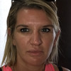 Frison Laure Chirurgie maxillo-faciale