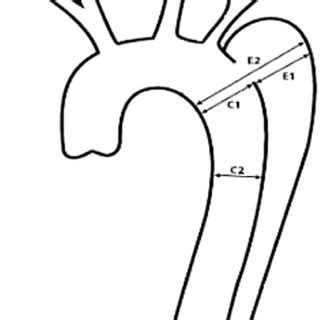 Canaud Ludovic Chirurgie vasculaire