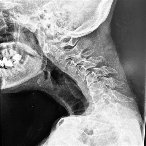 Charosky Sebastien Chirurgie orthopédique