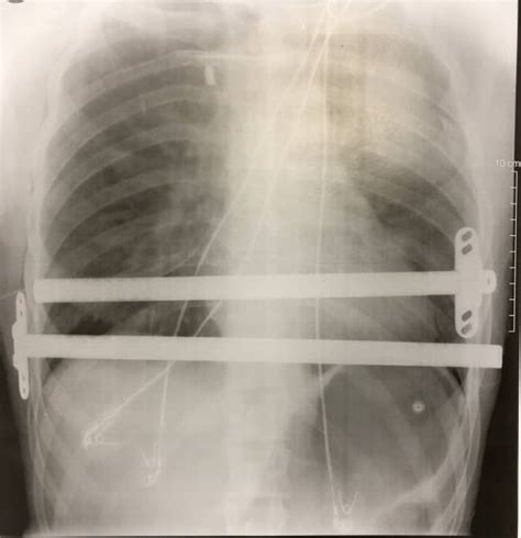Orsini Bastien Chirurgie vasculaire