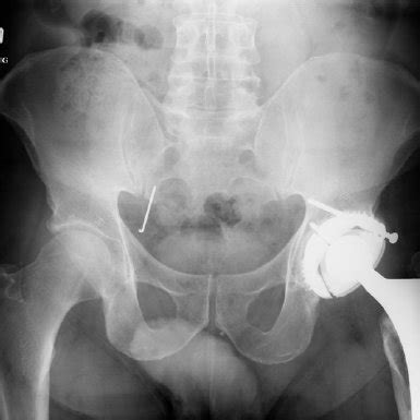 Ballas Richard Chirurgie orthopédique