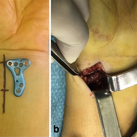 Falcone Marc-Olivier Chirurgie orthopédique